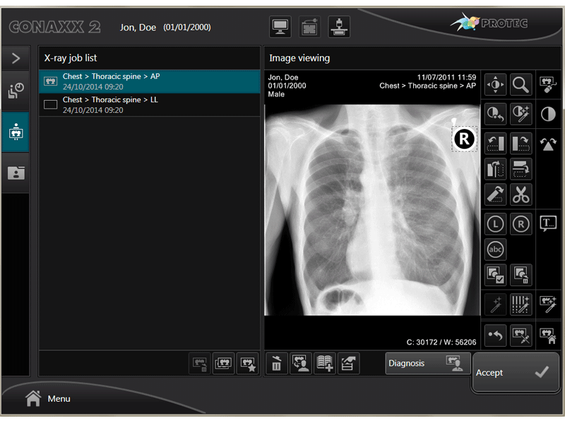 X ray process viewing software medical systems upgrade precise diagnose
