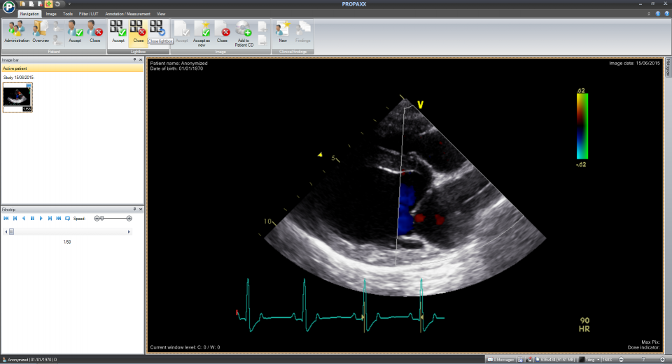 PROPAXX VET software for viewing, processing and archiving diagnosis of x-ray images.