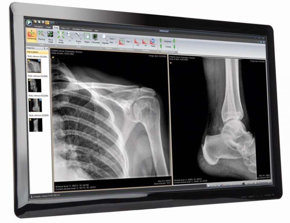 software x ray global trade medical supplies