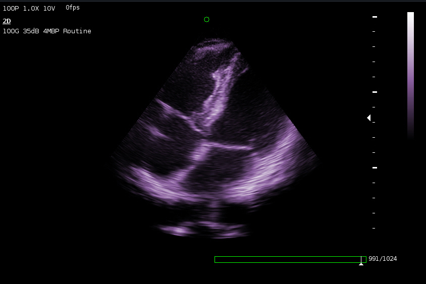 ultrasound 3d 4d color doppler gain images