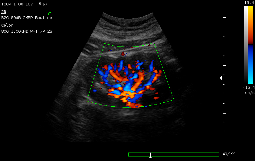 ultrasound 3d 4d color doppler gain images